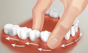 Шатается зуб — причины и симптомы, как укрепить шатающиеся зубы