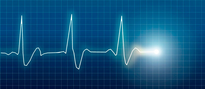 Причины нарушения синусового ритма сердца